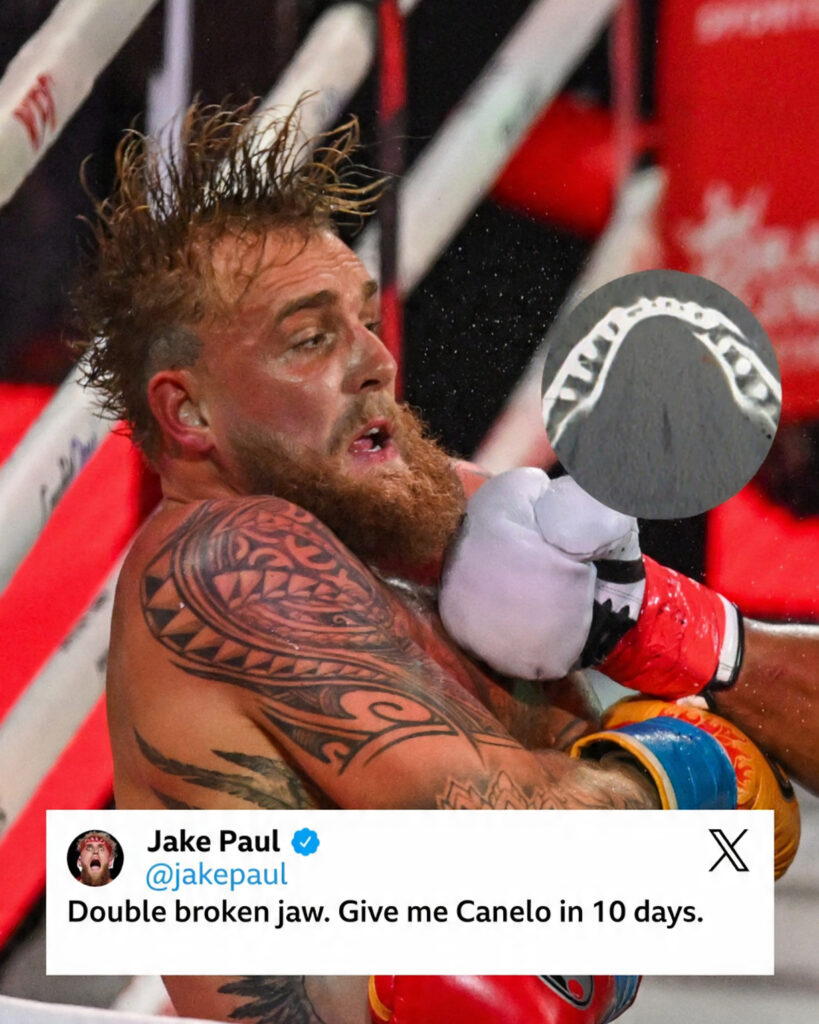 Jake Paul Claims Broken Jaw